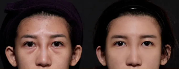 向美博士葉黃素1736324877802286.jpg 向美博士葉黃素